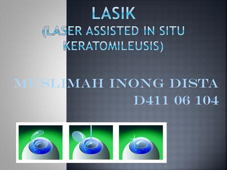 LASIK (Laser Assisted in Situ Keratomileusis)