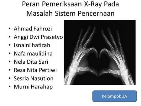Peran Pemeriksaan X-Ray Pada Masalah Sistem Pencernaan