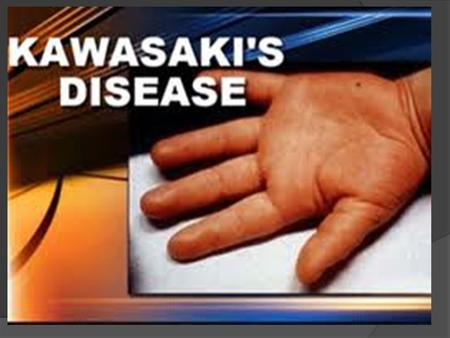 Penyakit Kawasaki ditemukan oleh Dr Tomisaku Kawasaki di Jepang tahun 1967 dan saat itu dikenal sebagai mucocutaneous lymphnode syndrome. Penampakan.
