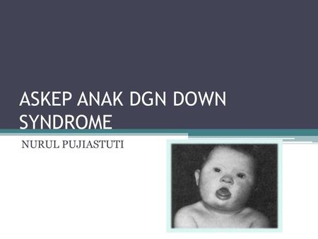 ASKEP ANAK DGN DOWN SYNDROME