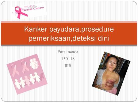Kanker payudara,prosedure pemeriksaan,deteksi dini