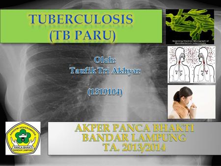 TUBERCULOSIS (TB PARU)
