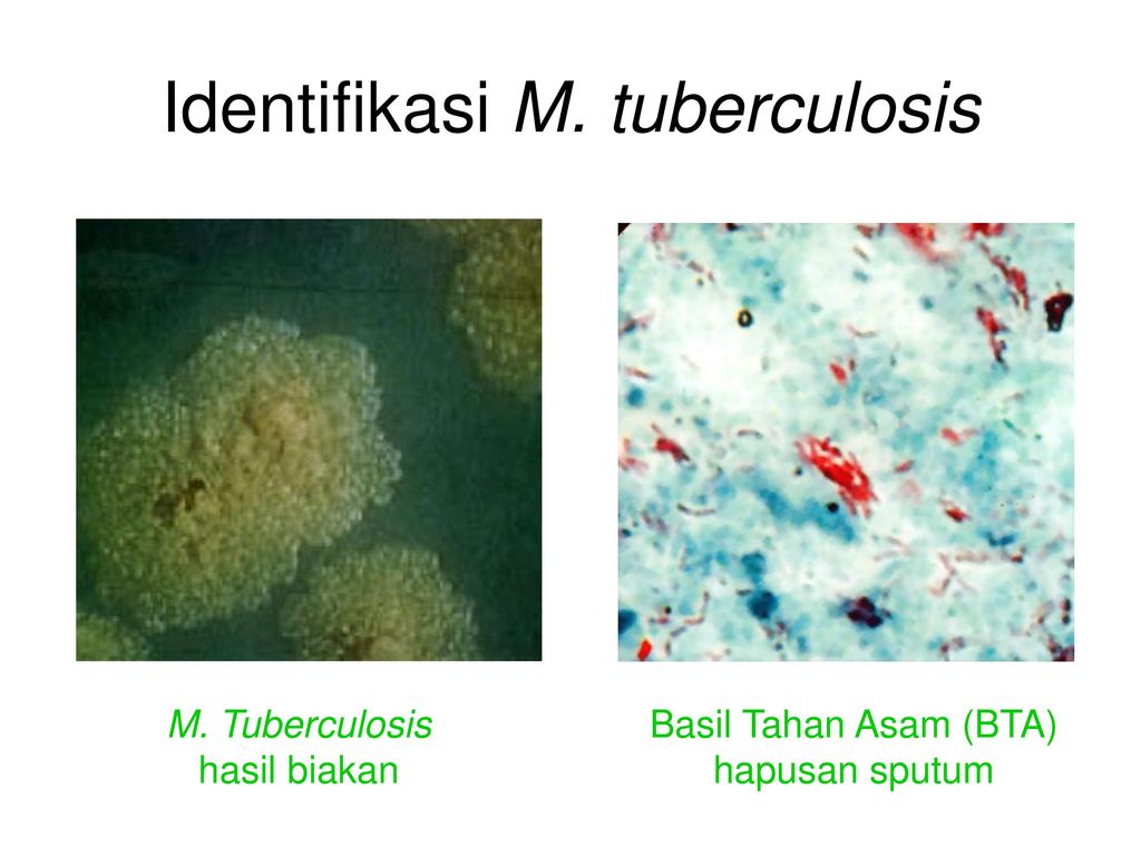 Identifikasi M. tuberculosis