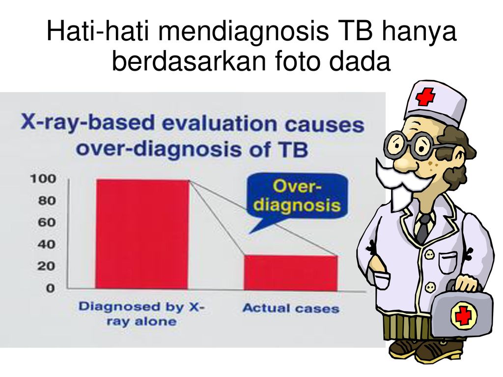 Hati-hati mendiagnosis TB hanya berdasarkan foto dada