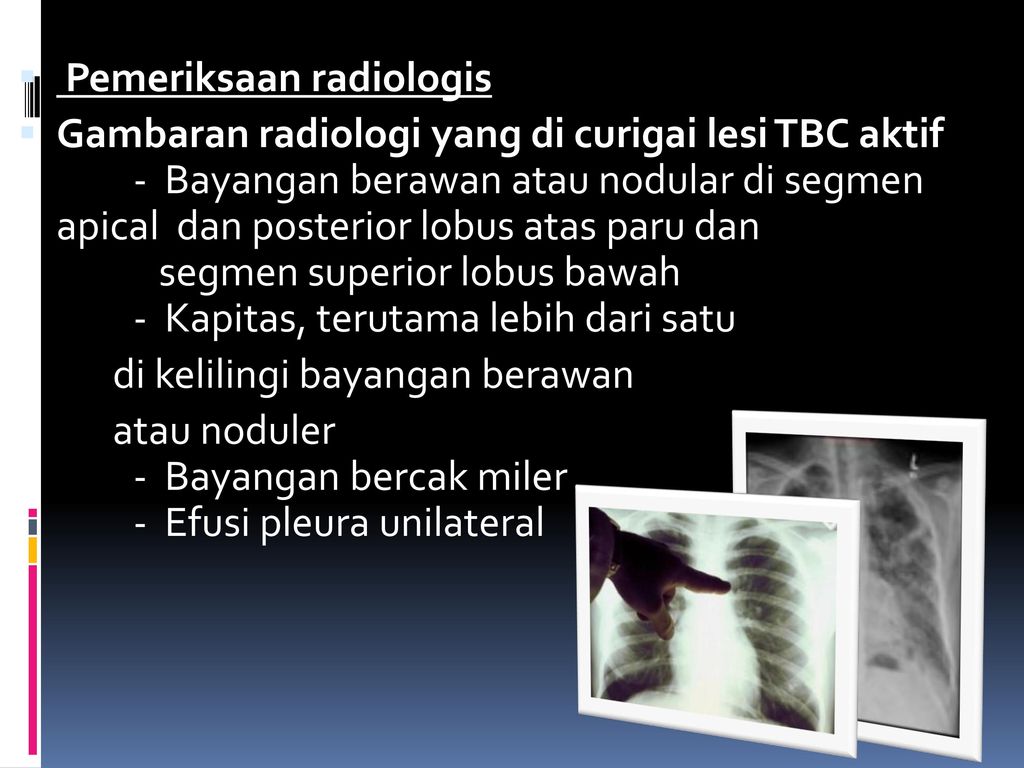 Pemeriksaan radiologis
