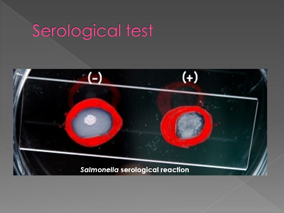 Serological test Salmonella serological reaction