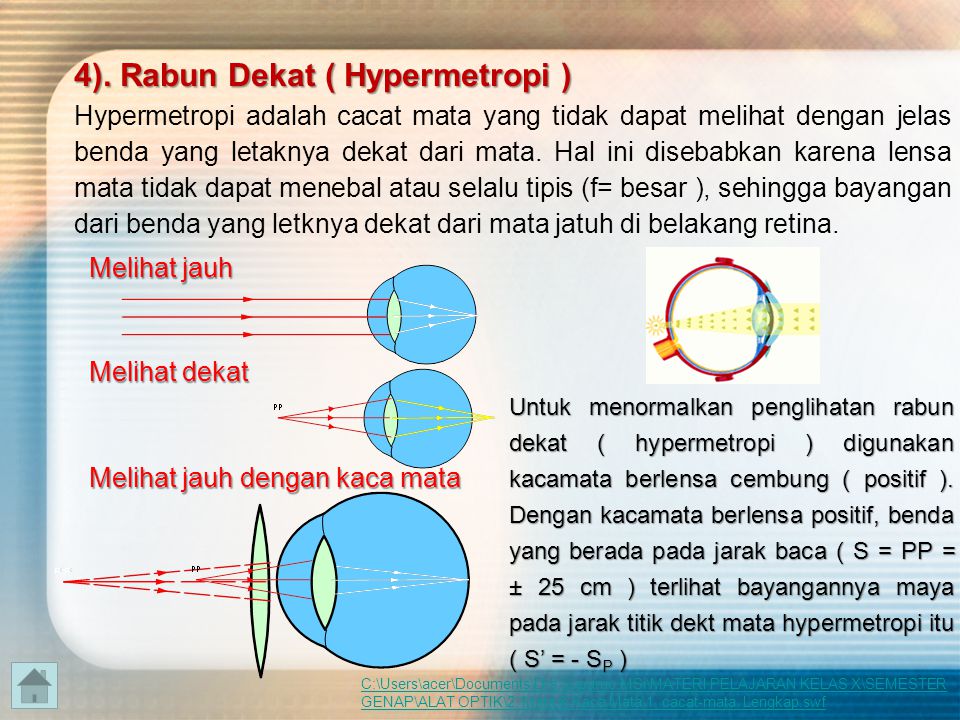 4). Rabun Dekat ( Hypermetropi )