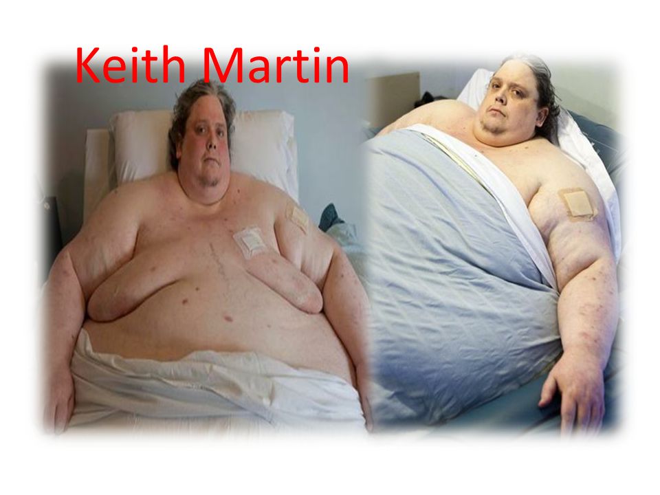Keith Martin Keith Martin ini menimbang beratnya dan yang paling mengejutkan adalah ia memiliki berat 812 pounds (58-stone).