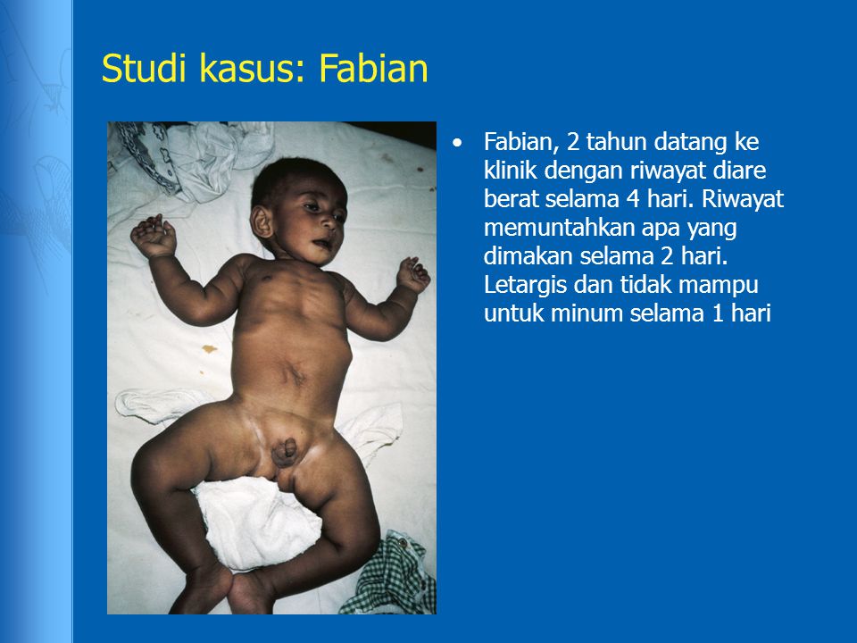 Studi kasus: Fabian