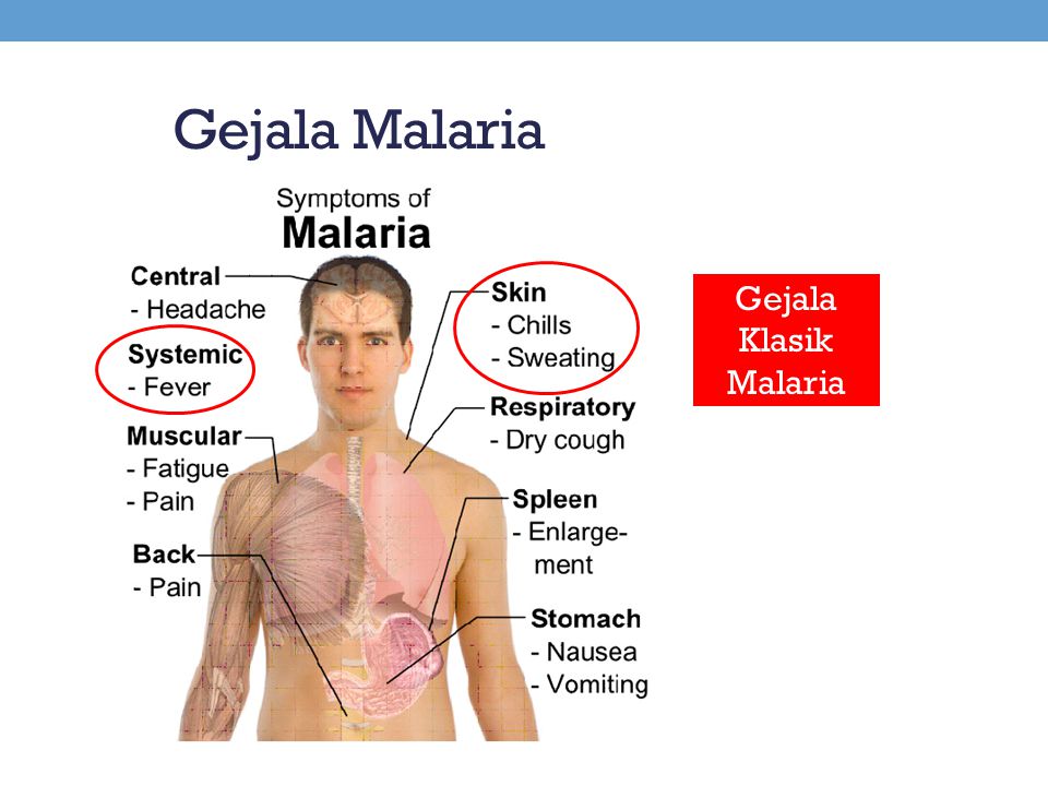 Gejala Malaria Gejala Klasik Malaria