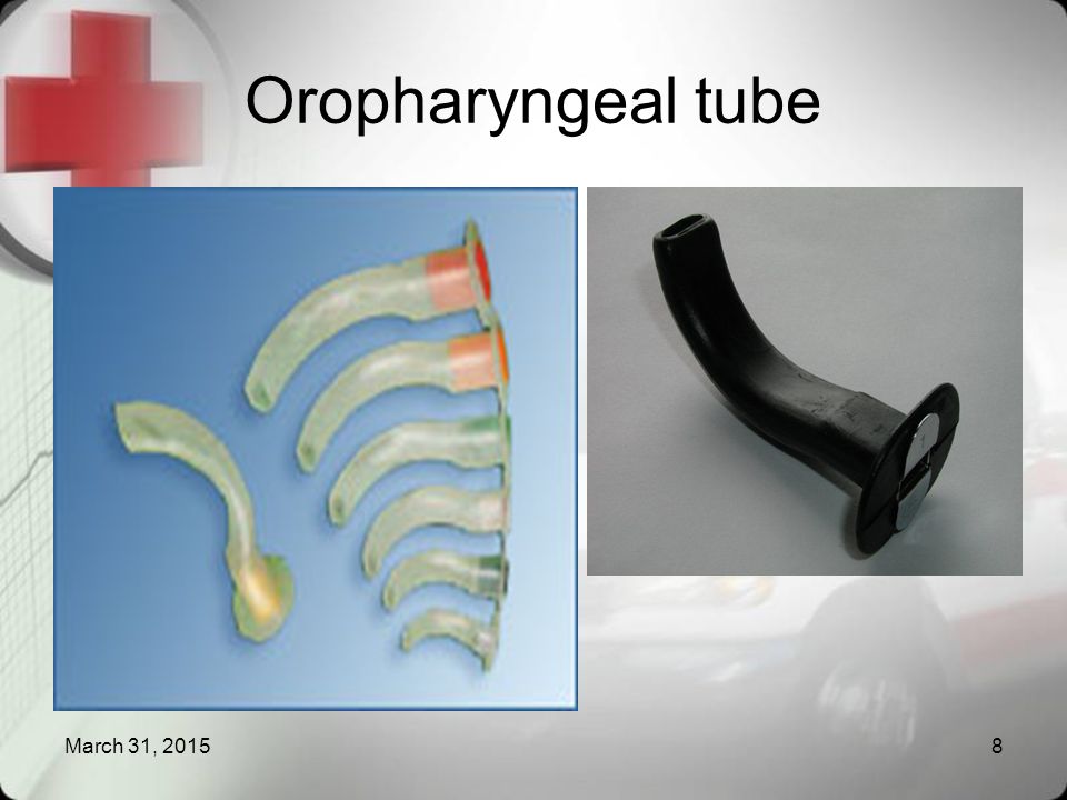 Oropharyngeal tube April 9, 2017