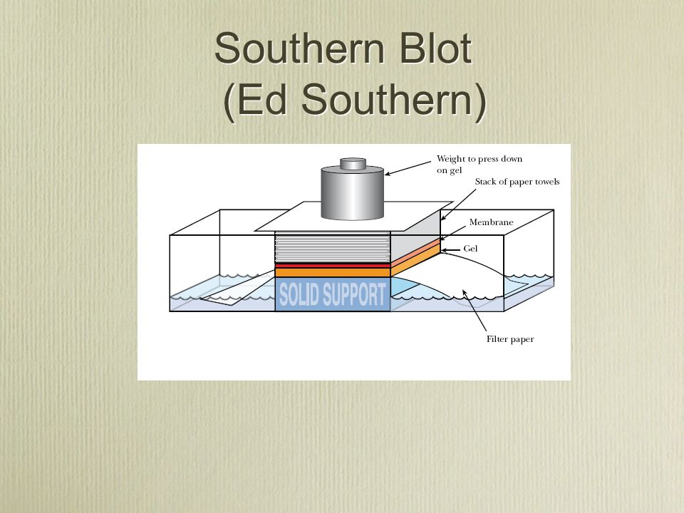 Southern Blot (Ed Southern)