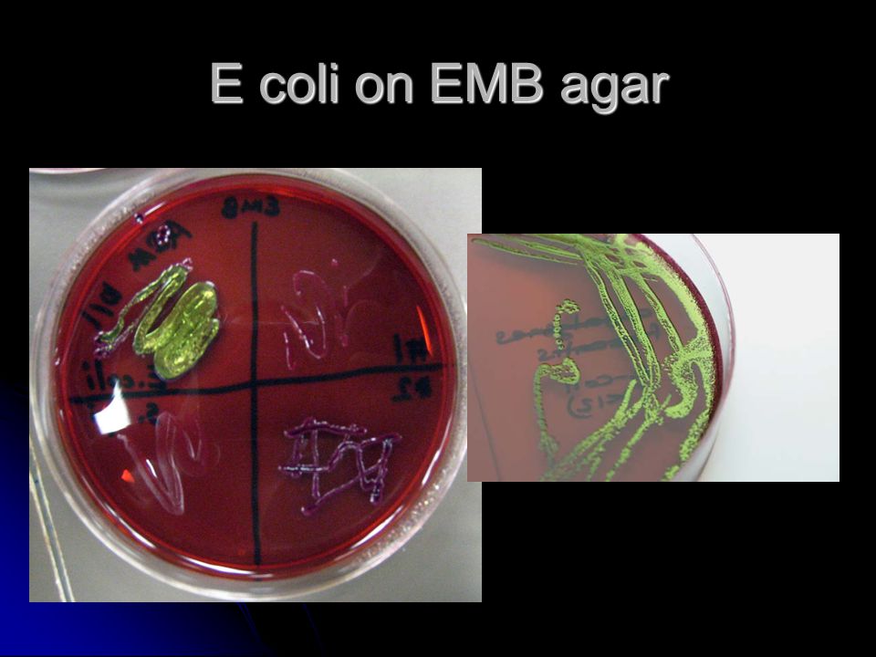 E coli on EMB agar