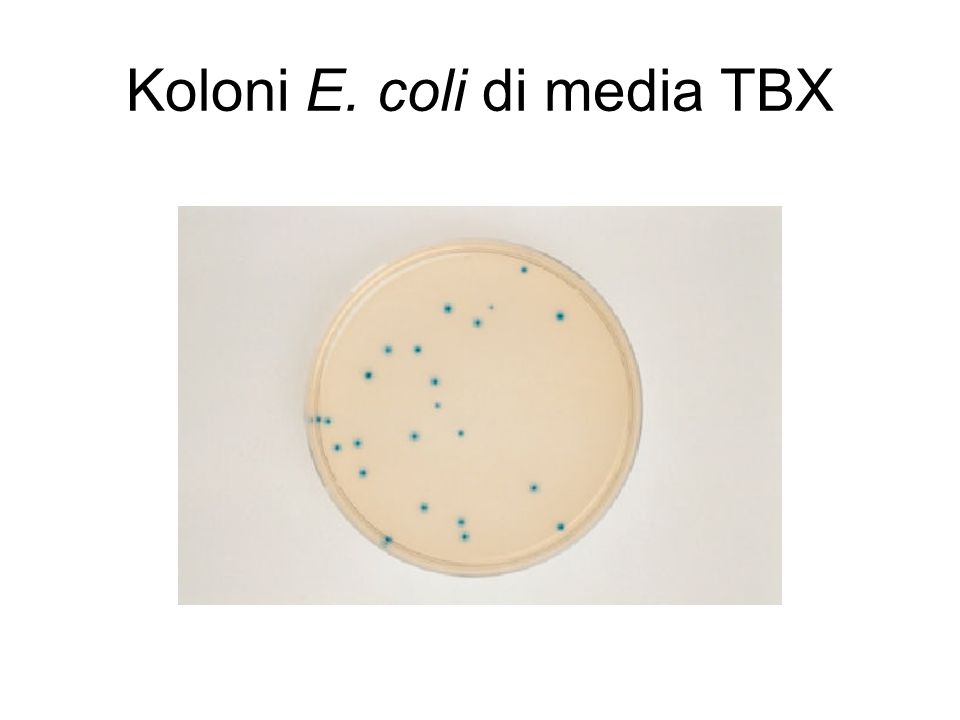 Koloni E. coli di media TBX