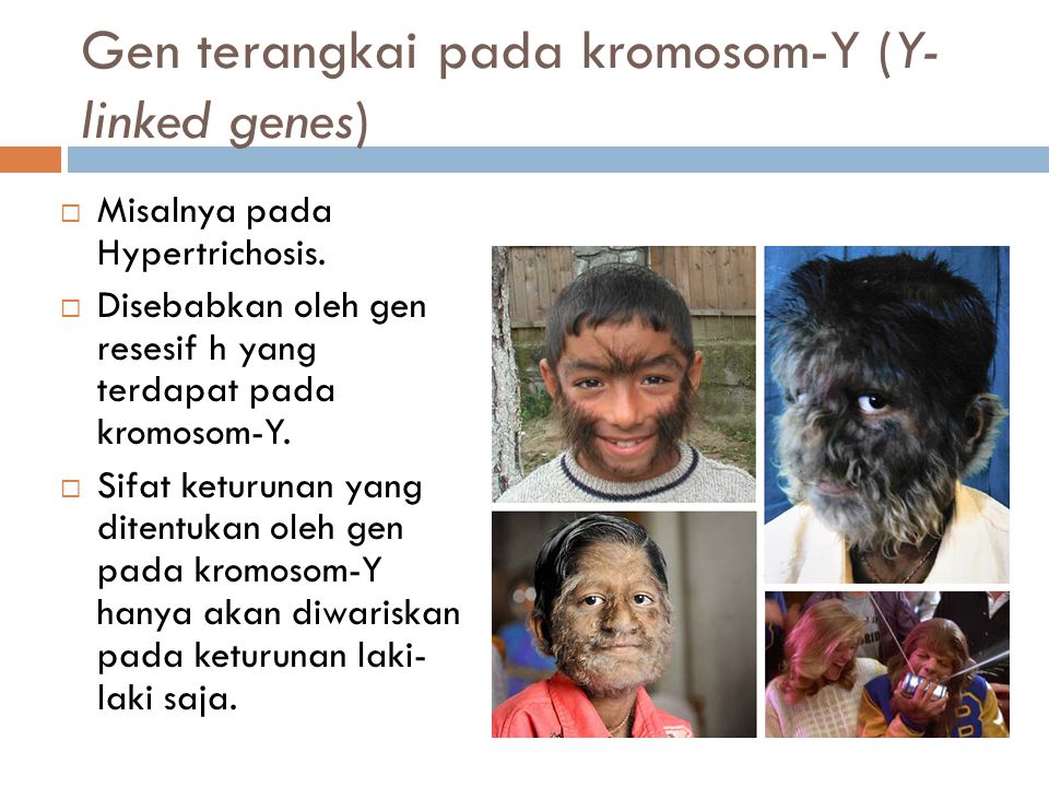 Gen terangkai pada kromosom-Y (Y-linked genes)