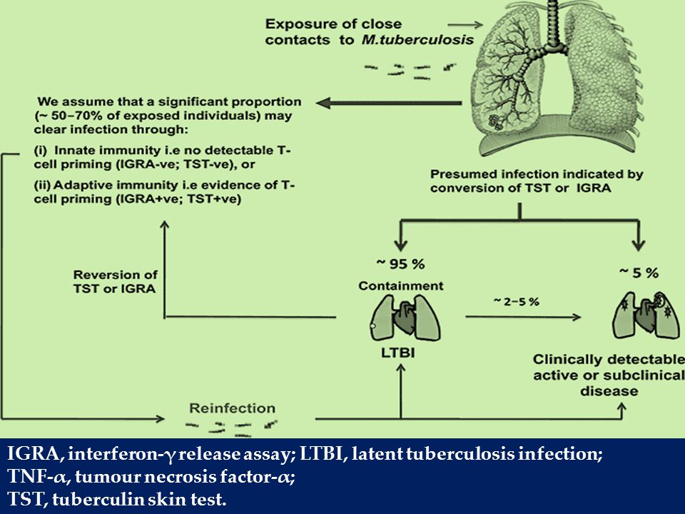 IGRA, interferon-γ release assay; LTBI, latent tuberculosis infection;