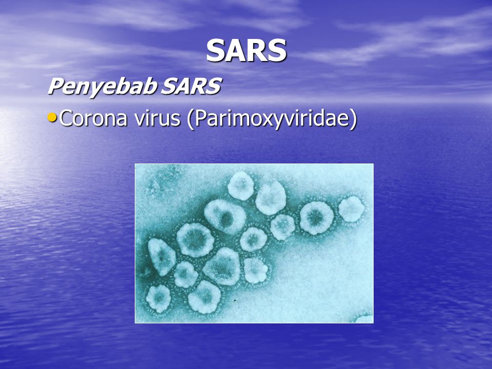 Penyebab SARS Corona virus (Parimoxyviridae)