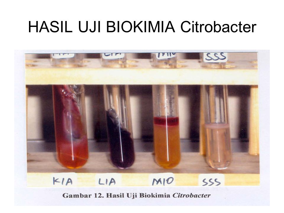 HASIL UJI BIOKIMIA Citrobacter