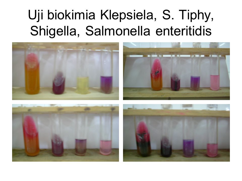 Uji biokimia Klepsiela, S. Tiphy, Shigella, Salmonella enteritidis