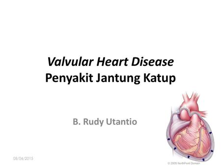 Valvular Heart Disease Penyakit Jantung Katup