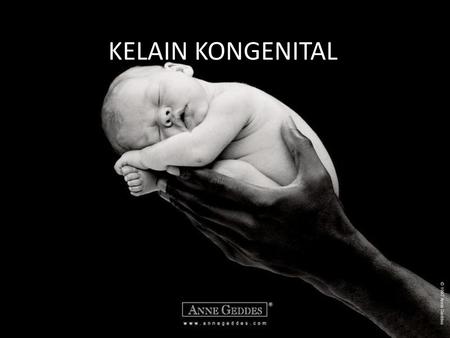 KELAIN KONGENITAL.