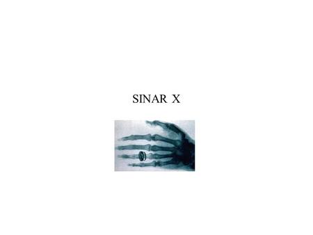 SINAR X.