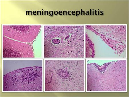 Meningoencephalitis.