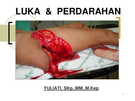 LUKA & PERDARAHAN YULIATI, SKp.,MM.,M.Kep.