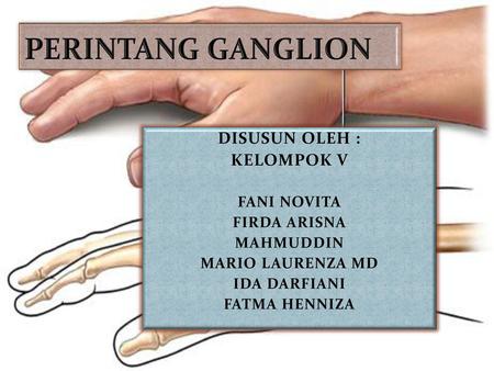 PERINTANG GANGLION DISUSUN OLEH : KELOMPOK V FANI NOVITA FIRDA ARISNA