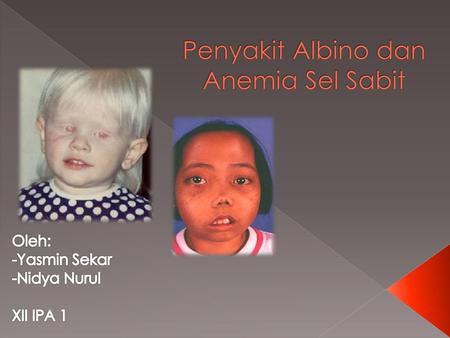 Penyakit Albino dan Anemia Sel Sabit