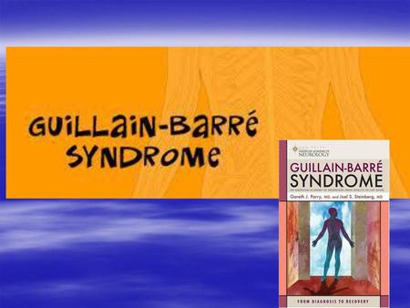 Sindrom Guillain–Barré