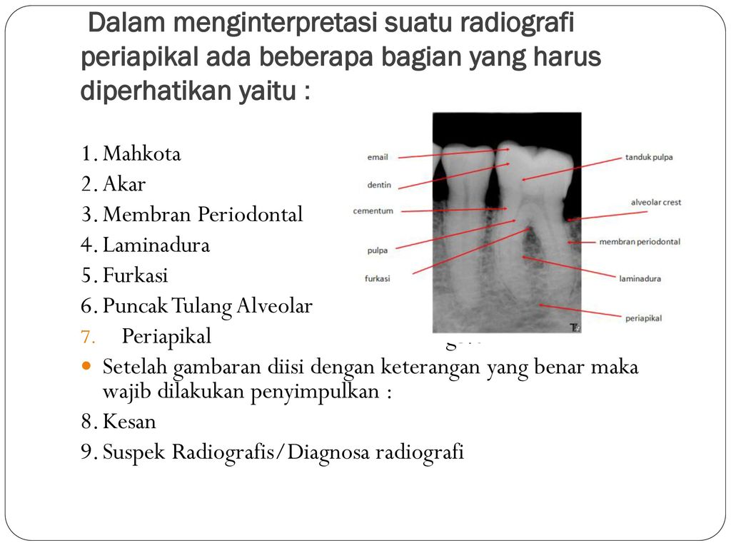 Dalam menginterpretasi suatu radiografi periapikal ada beberapa bagian yang harus diperhatikan yaitu :