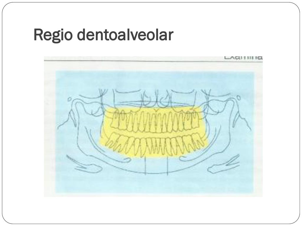 Regio dentoalveolar