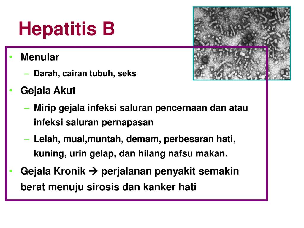 Hepatitis B Menular Gejala Akut