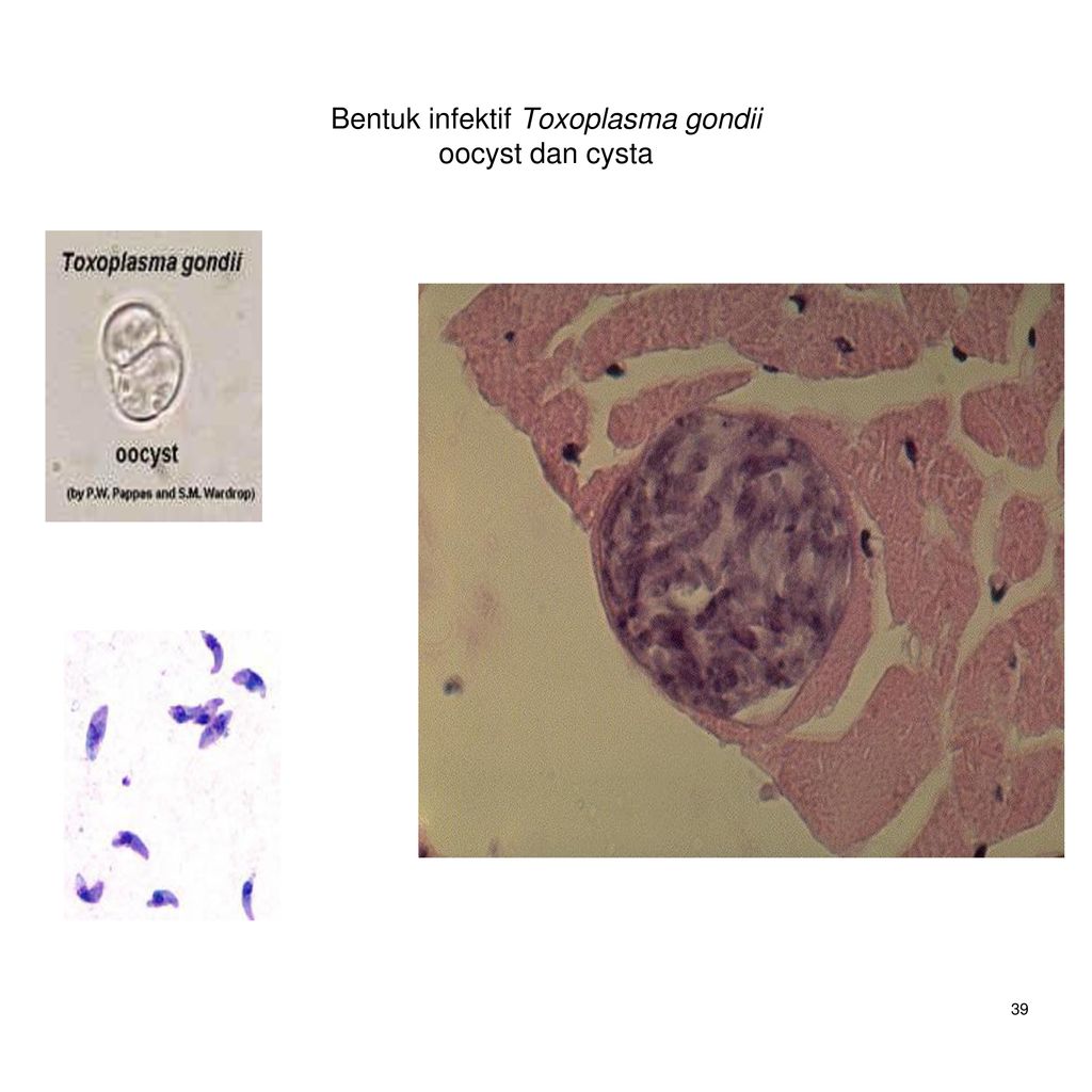 Toxoplasma gondii. Морфология токсоплазмы. Токсоплазма гондии морфология. Локализация токсоплазмы. Строение токсоплазмы Toxoplasma gondii.