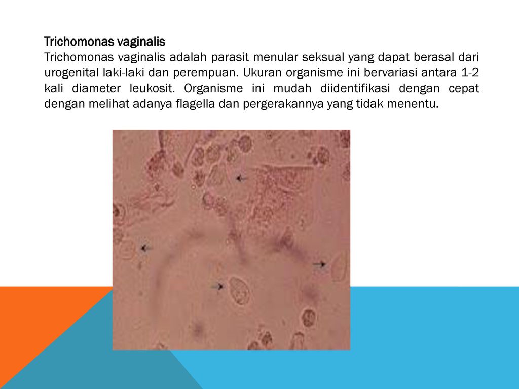 Trichomonas vaginalis пцр