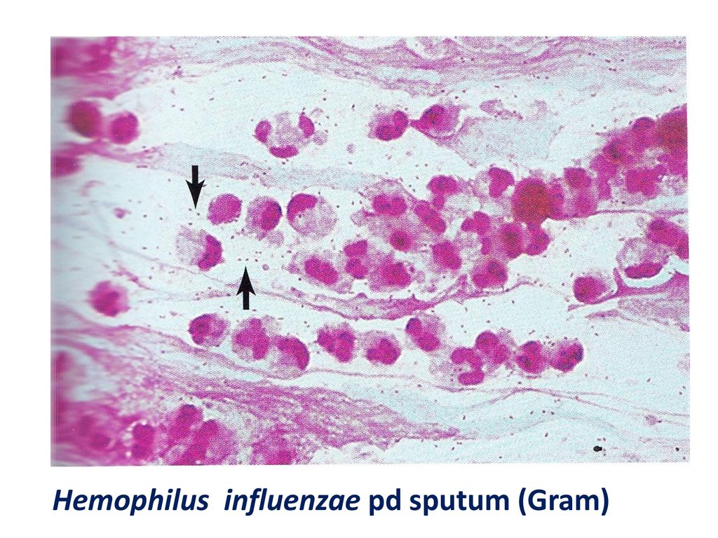Haemophilus influenzae эндотоксины. Haemophilus influenzae Комаровский. Influenzae тон. Haemophilus spp у мужчин