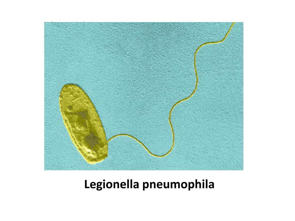 Легионелла пневмофила. Legionella pneumophila устойчивость во внешней среде. Legionella pneumophila входные ворота. Легионеллы колонии.