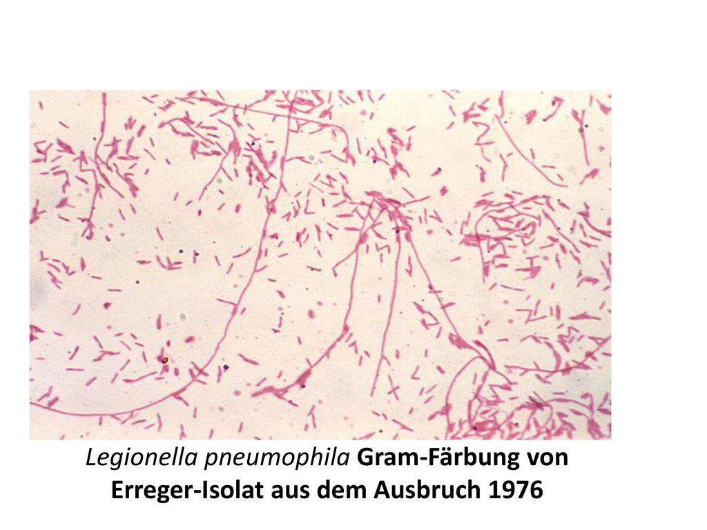 Legionella pneumophila. Легионелла пневмония морфология. Legionella pneumophila микробиология. Легионеллы микробиология морфология. Легионелла микроскопия.