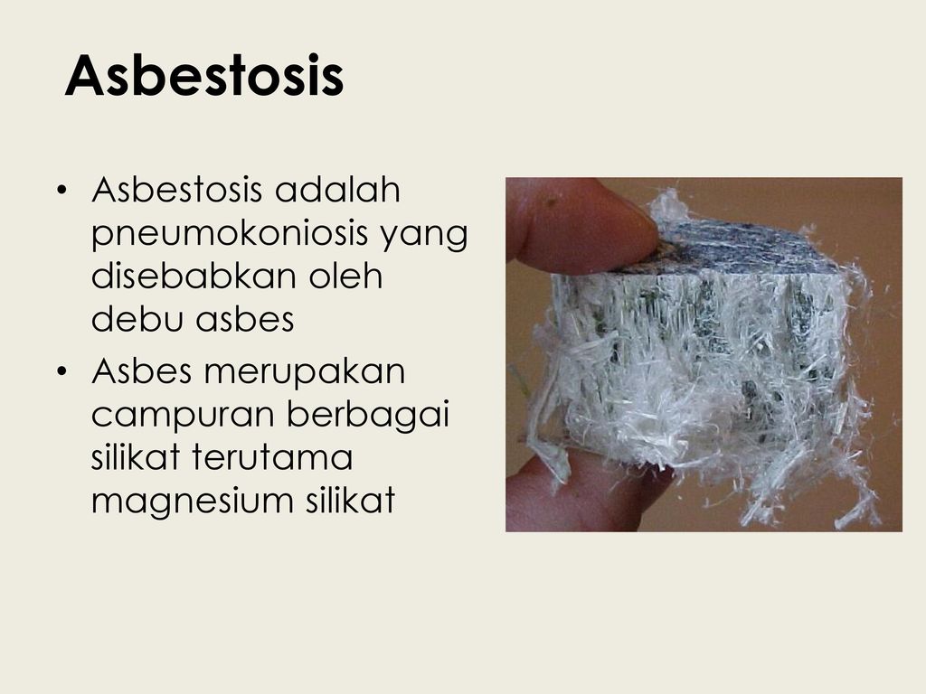 Asbestosis adalah