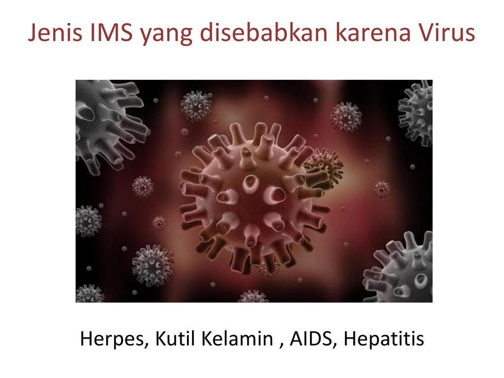 Jenis IMS yang disebabkan karena Virus