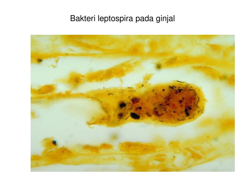 Bakteri leptospira pada ginjal