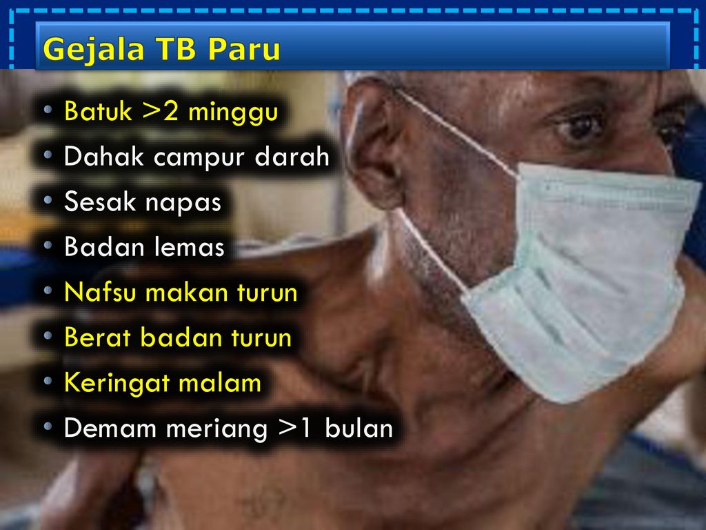 Gejala TB Paru Batuk >2 minggu. Dahak campur darah. Sesak napas. Badan lemas. Nafsu makan turun.