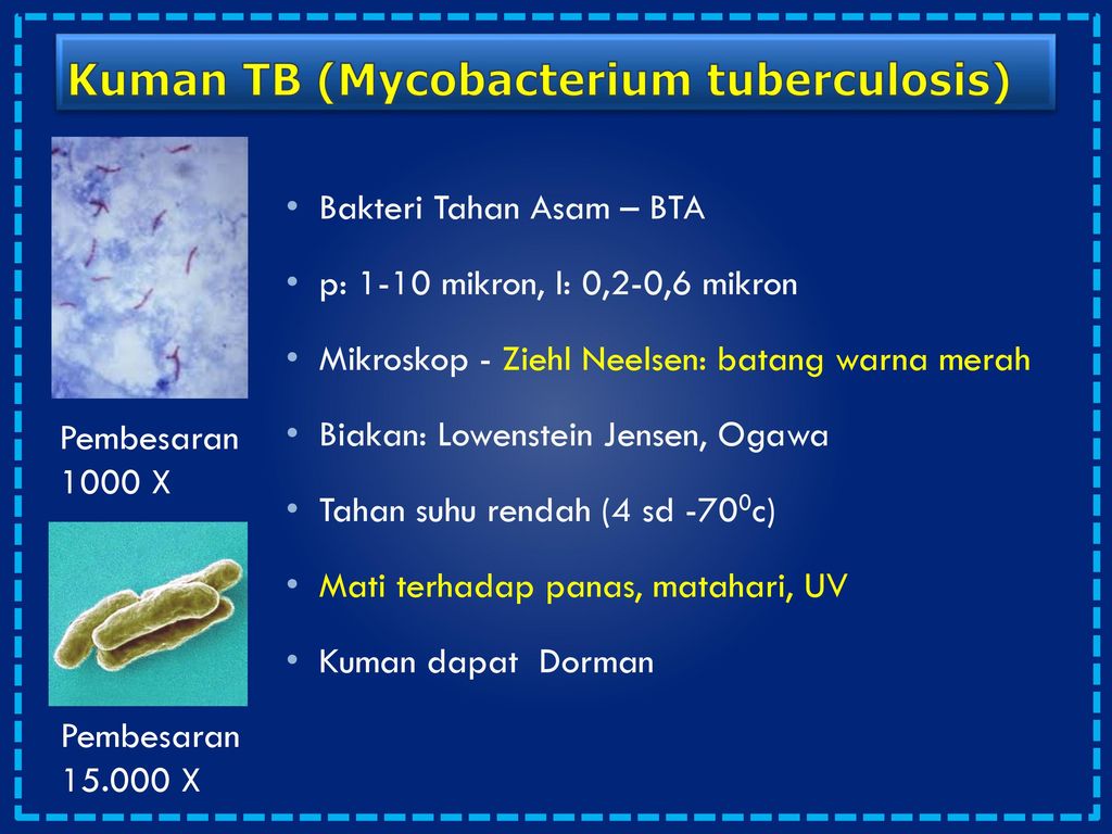 Kuman TB (Mycobacterium tuberculosis)