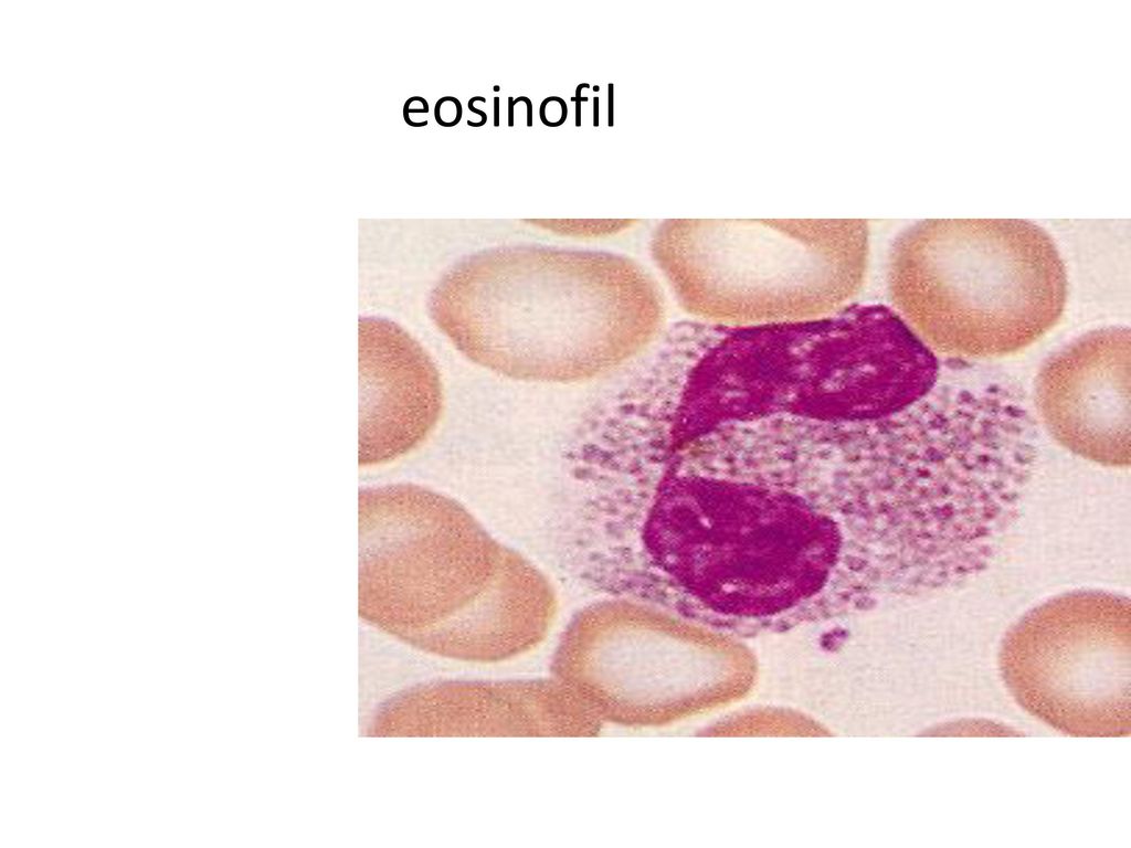 eosinofil