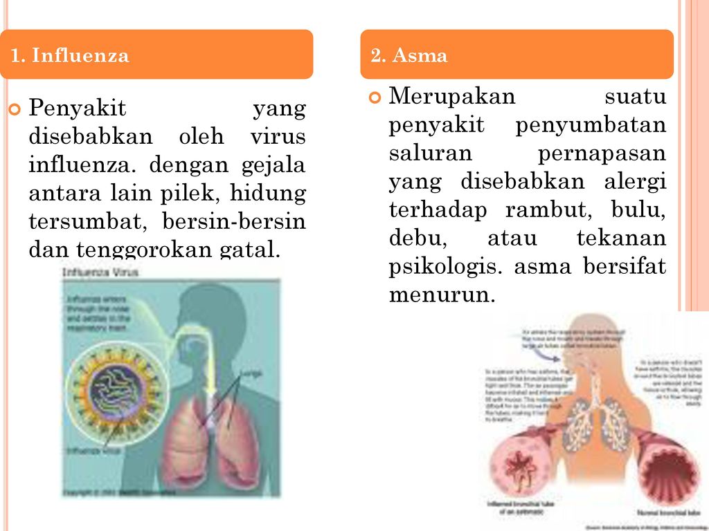 1. Influenza 2. Asma.