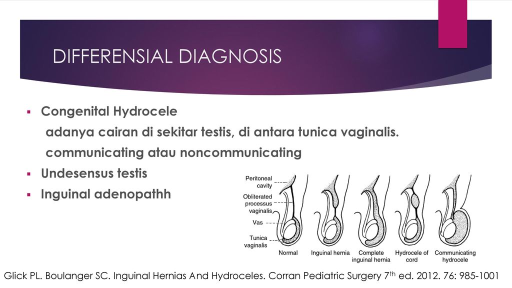 Saline Penis