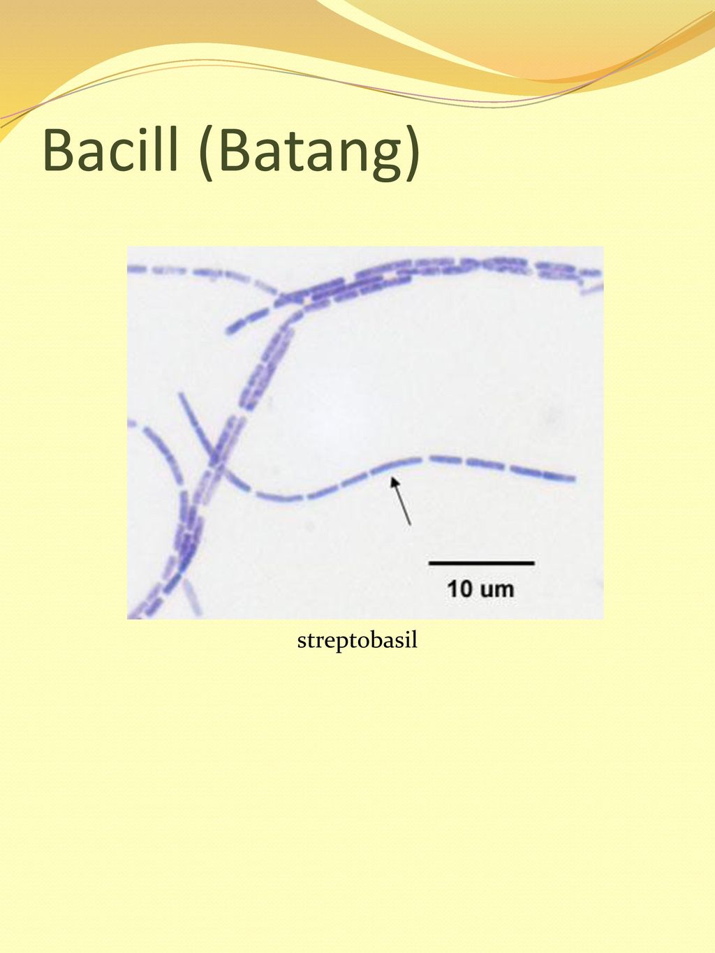 Bacill (Batang) streptobasil