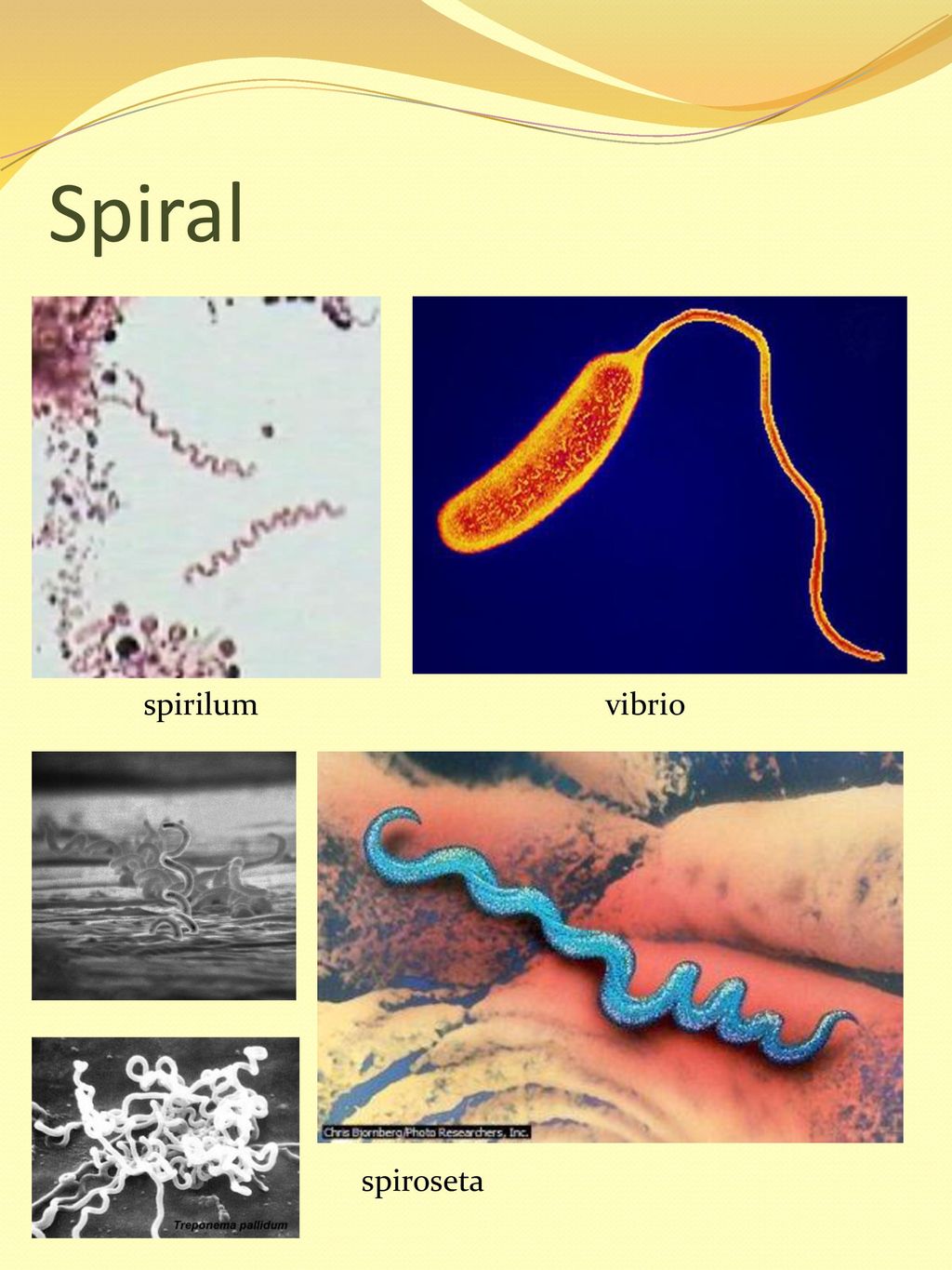 Spiral spirilum vibrio spiroseta