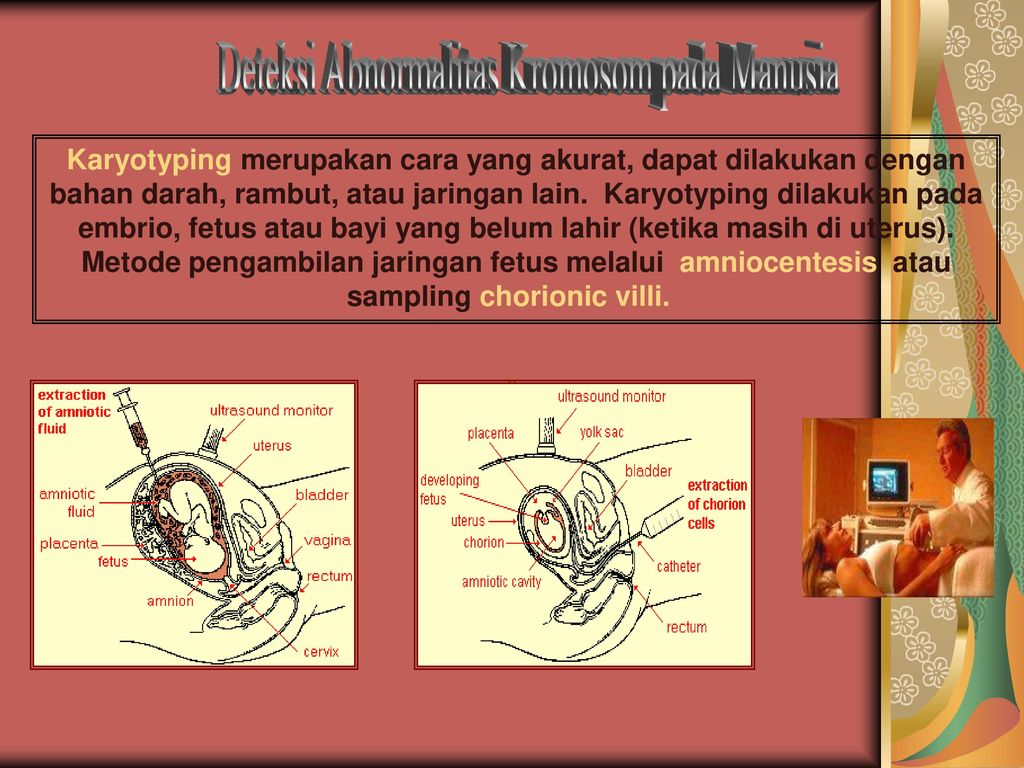 Penentuan Jenis Kelamin Sex Determination Ppt Download 7034